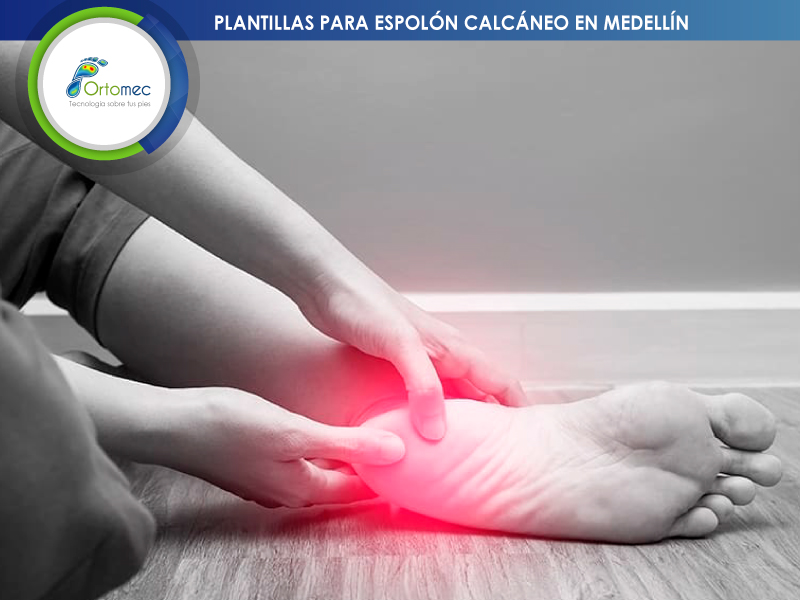 Espolón Calcáneo en deportistas