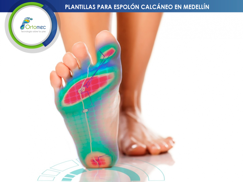 Profesionales en Plantillas de espolón Calcáneo