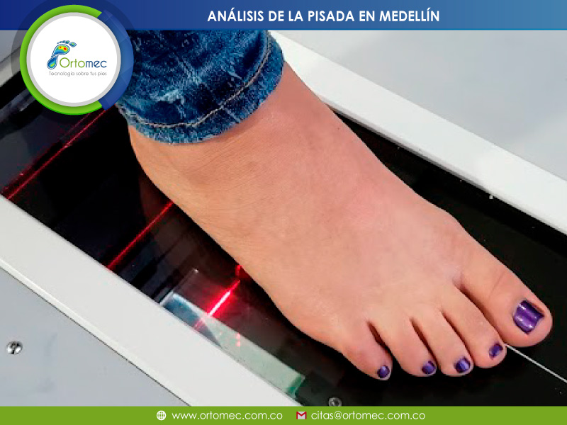 Análisis de la Pisada