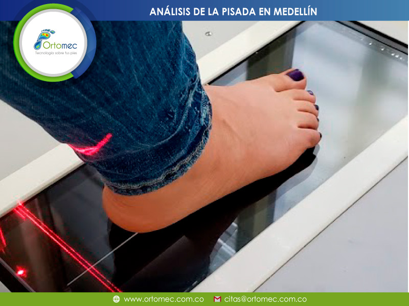Análisis y estudio de la pisada en Cali