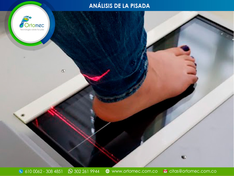 Análisis de la pisada en Cali