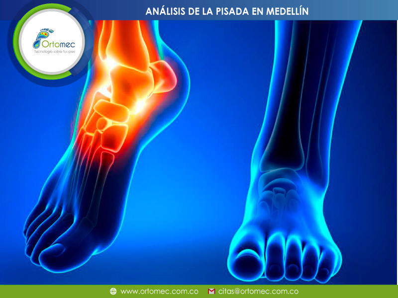 Profesionales  el estudio de la pisada