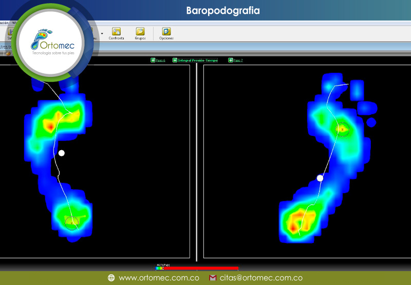 plantillas ortopedicas en Tunja